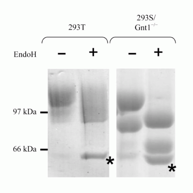 Eukaryotic expression: developments for structural proteomics