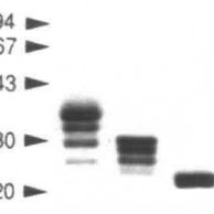 Expression-of-soluble-recombinant-glycoproteins-with-predefined-glycosylation–application-to-the-crystallization-of-the-T-cell-glycoprotein-CD2-featured-iamge T Cell, Simon Davis Lab Oxford