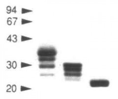 Expression-of-soluble-recombinant-glycoproteins-with-predefined-glycosylation–application-to-the-crystallization-of-the-T-cell-glycoprotein-CD2-featured-iamge T Cell, Simon Davis Lab Oxford