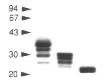 Expression-of-soluble-recombinant-glycoproteins-with-predefined-glycosylation–application-to-the-crystallization-of-the-T-cell-glycoprotein-CD2-featured-iamge T Cell, Simon Davis Lab Oxford